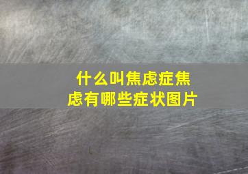 什么叫焦虑症焦虑有哪些症状图片