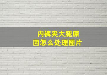 内裤夹大腿原因怎么处理图片