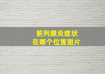 前列腺炎症状在哪个位置图片