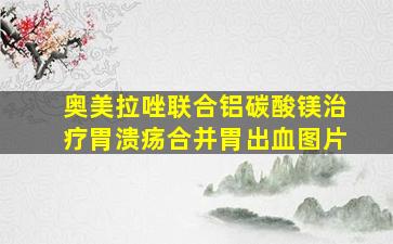 奥美拉唑联合铝碳酸镁治疗胃溃疡合并胃出血图片