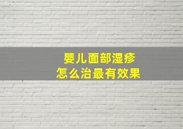 婴儿面部湿疹怎么治最有效果