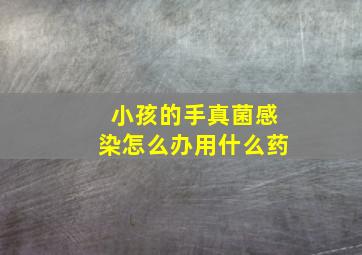 小孩的手真菌感染怎么办用什么药