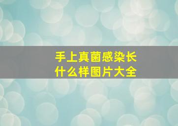 手上真菌感染长什么样图片大全