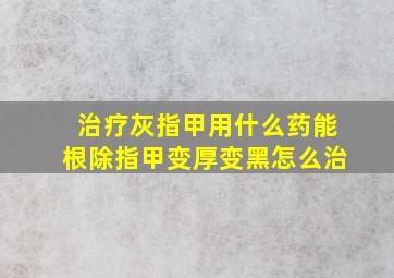 治疗灰指甲用什么药能根除指甲变厚变黑怎么治