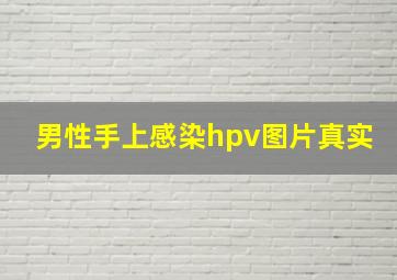 男性手上感染hpv图片真实