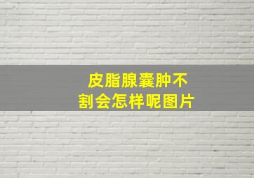 皮脂腺囊肿不割会怎样呢图片