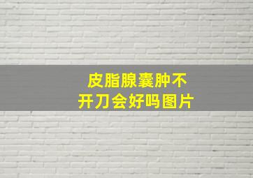 皮脂腺囊肿不开刀会好吗图片