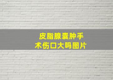 皮脂腺囊肿手术伤口大吗图片