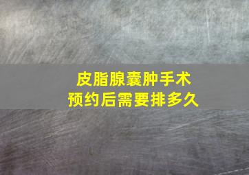 皮脂腺囊肿手术预约后需要排多久