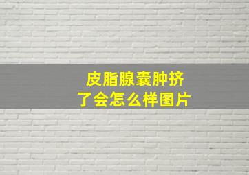 皮脂腺囊肿挤了会怎么样图片