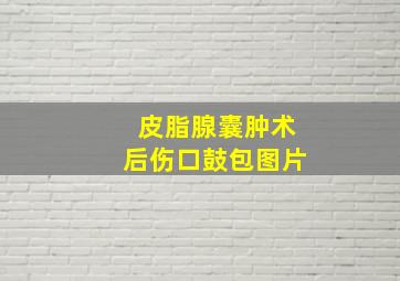 皮脂腺囊肿术后伤口鼓包图片