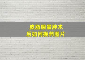 皮脂腺囊肿术后如何换药图片