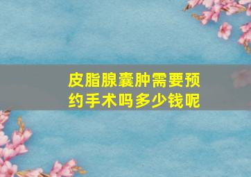 皮脂腺囊肿需要预约手术吗多少钱呢