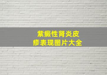 紫癜性肾炎皮疹表现图片大全