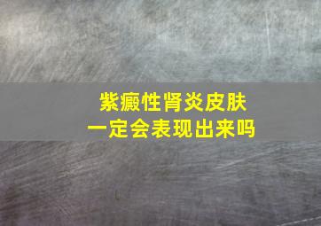 紫癜性肾炎皮肤一定会表现出来吗